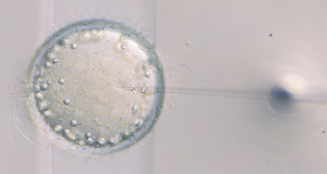 IVF Systems